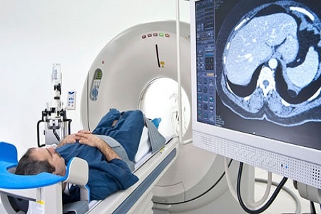 Hystero Laparoscopic