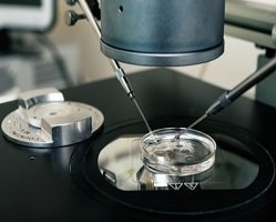 In Vitro Fertilization (IVF)