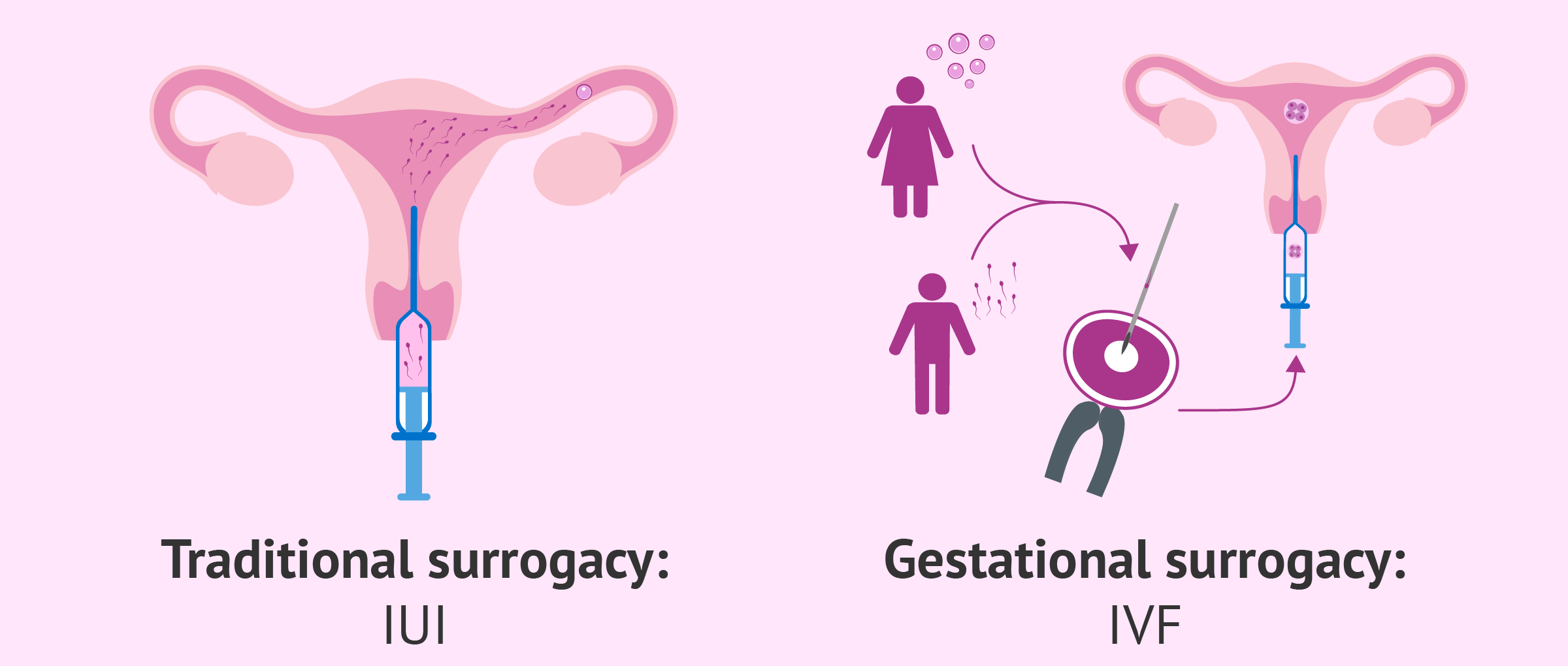 Gestational Surrogacy