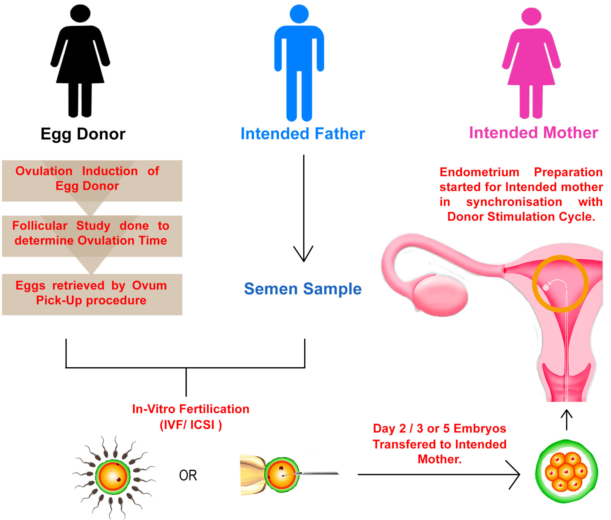 Donor Egg IVF