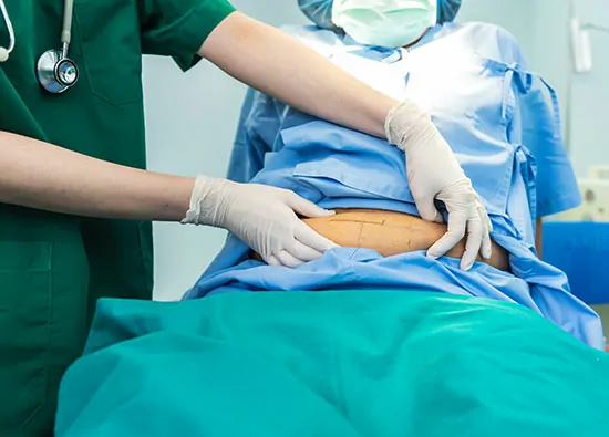 Laparoscopic Salpingectomy (Bilateral)
