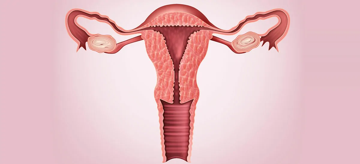 Vaginal Hysterectomy in Bangalore