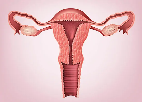 Hysterectomy (vaginal)