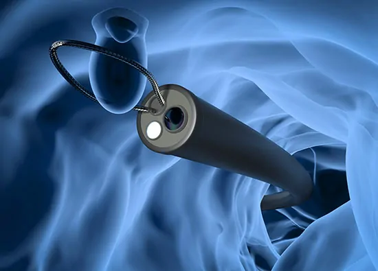 Hystero Laparoscopy + Ovarian Cystectomy