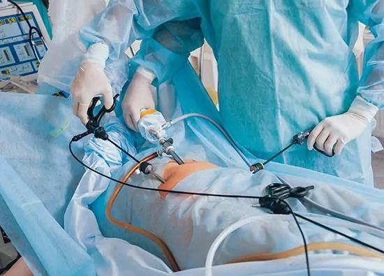 Hystero Laparoscopy + Ovarian Drilling
