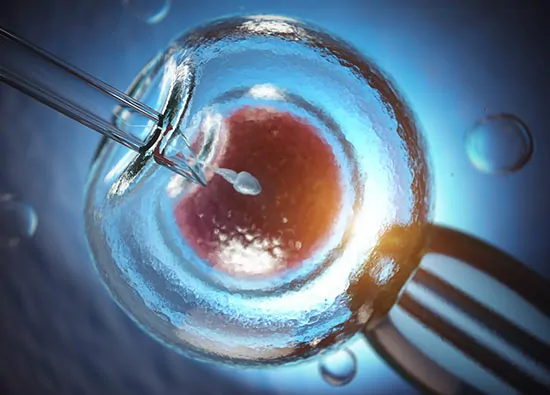 IVF