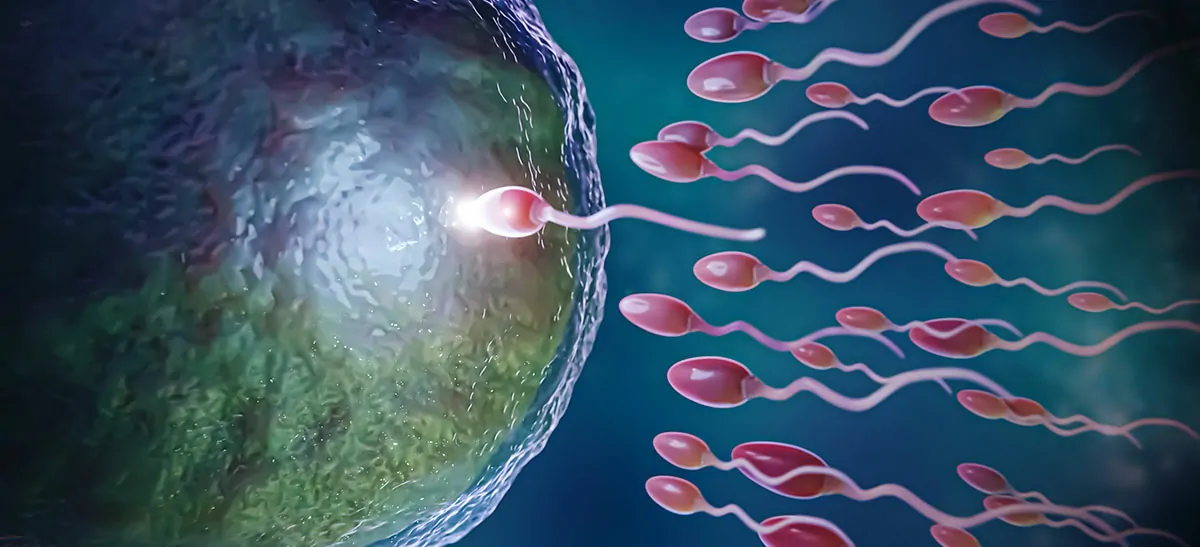 IUI