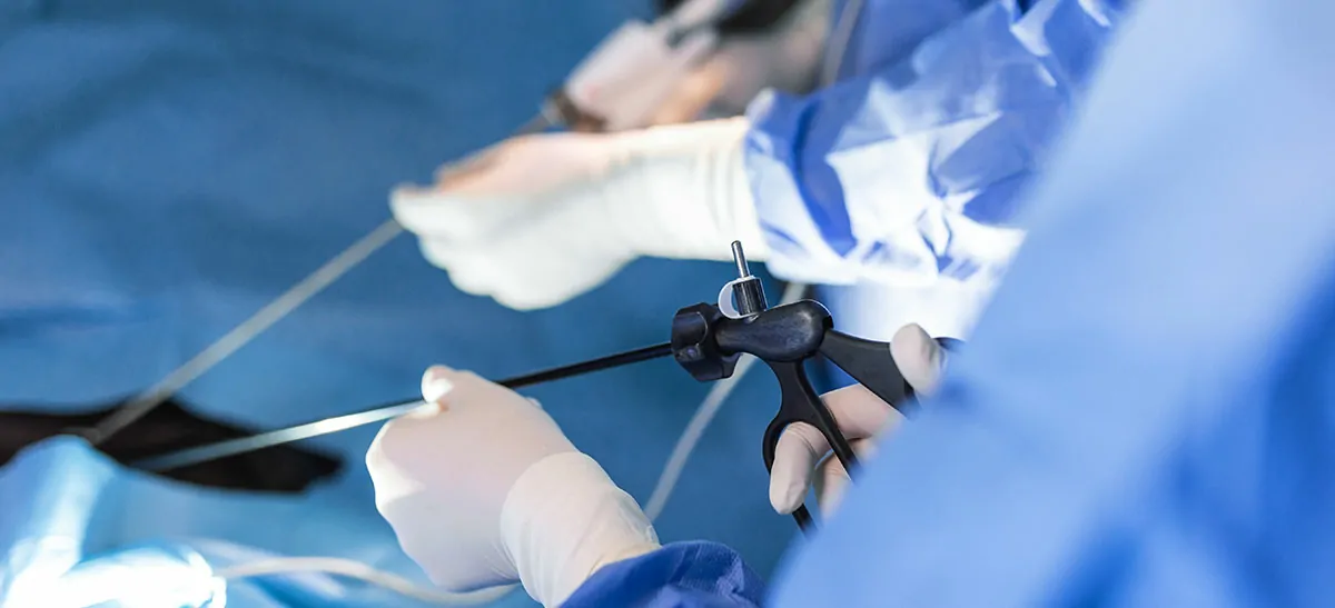 Laparoscopic Myomectomy