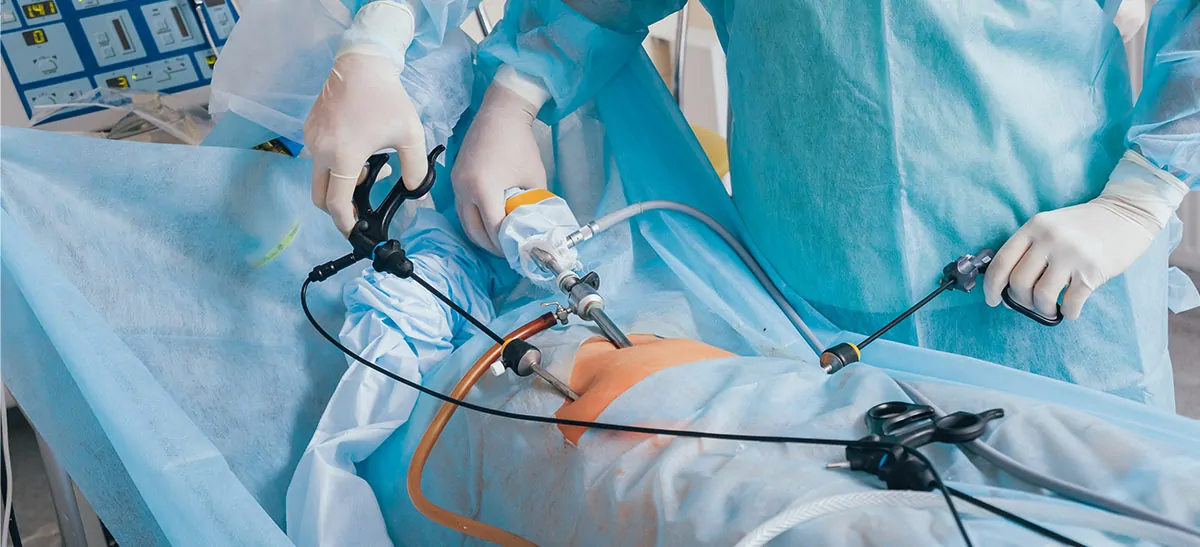 Hystero-Laparoscopy with Ovarian Drilling