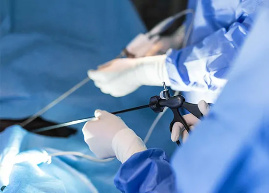 Laparoscopic Myomectomy